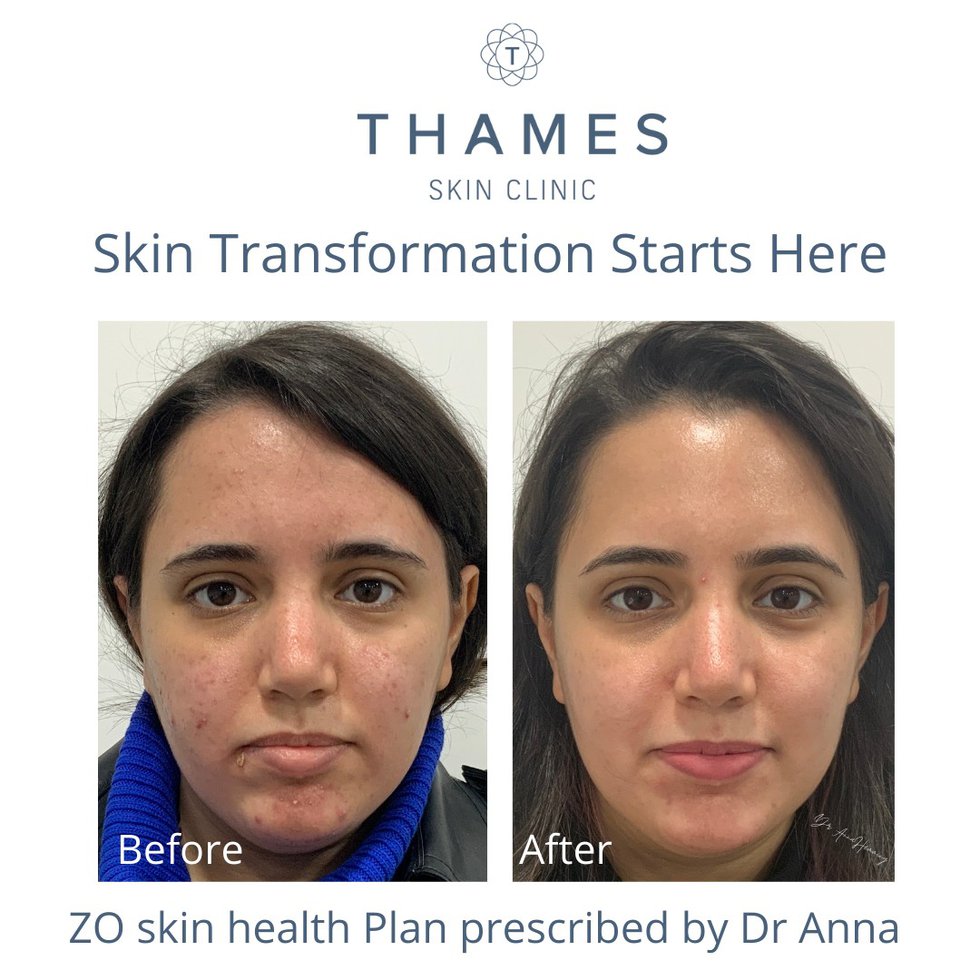 skin transformation.jpeg
